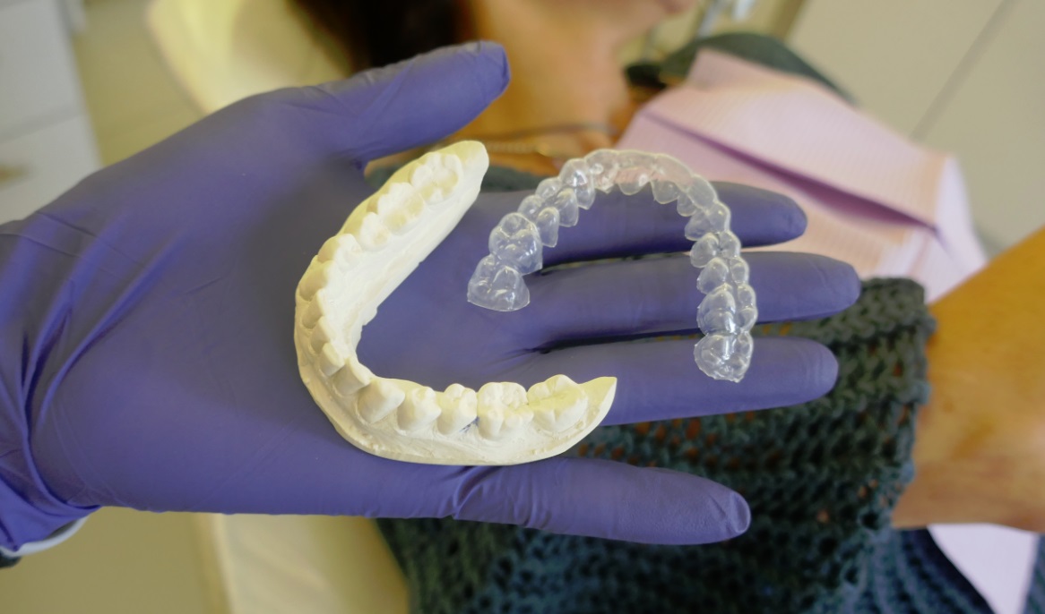 teeth mold plastic Venus teeth whitening custom fit trays peroxide take home